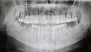 dolor-orofacial-1.jpg