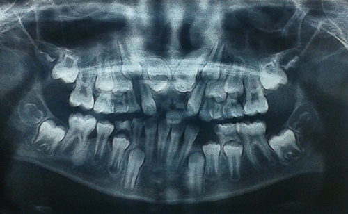 odontoma-daniela-1.jpg