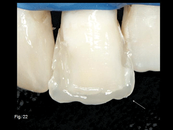 Diapositiva22.gif