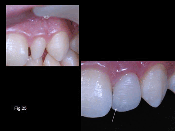 Diapositiva25.gif