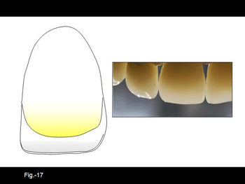 Diapositiva17.gif