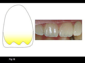 Diapositiva18.gif