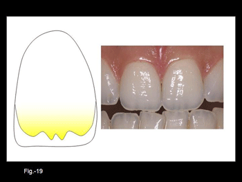 Diapositiva19.gif