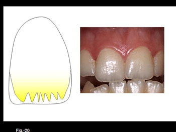 Diapositiva20.gif