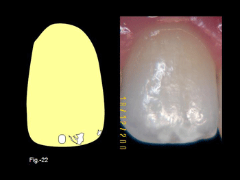 Diapositiva22.gif