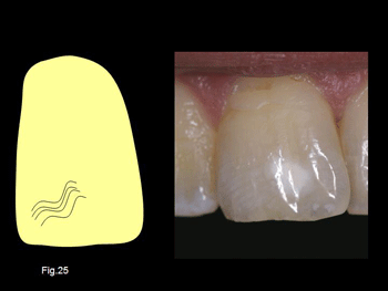 Diapositiva25.gif