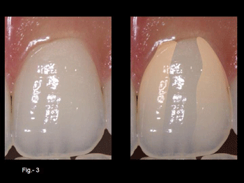 Diapositiva3.gif