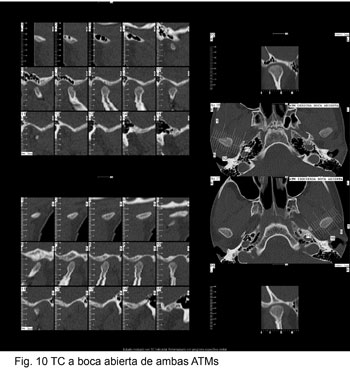 fig10.jpg