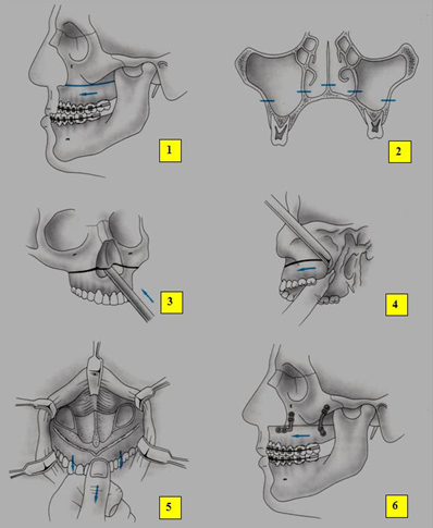 figura1.jpg