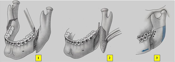 figura2.jpg