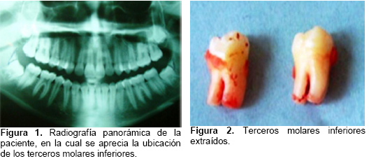 id115_fig1.jpg