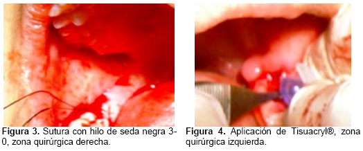 id115_fig2.jpg